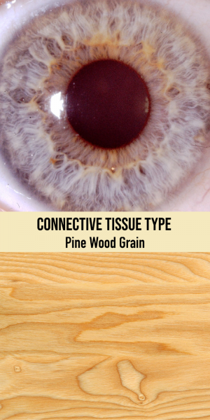 Connective Tissue Type / Pine Wood Grain