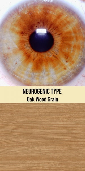 Neurogenic Type / Oak Wood Grain