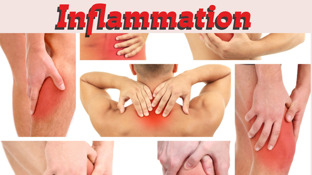 Inflammation: The Underlying Cause of Pain and Disease